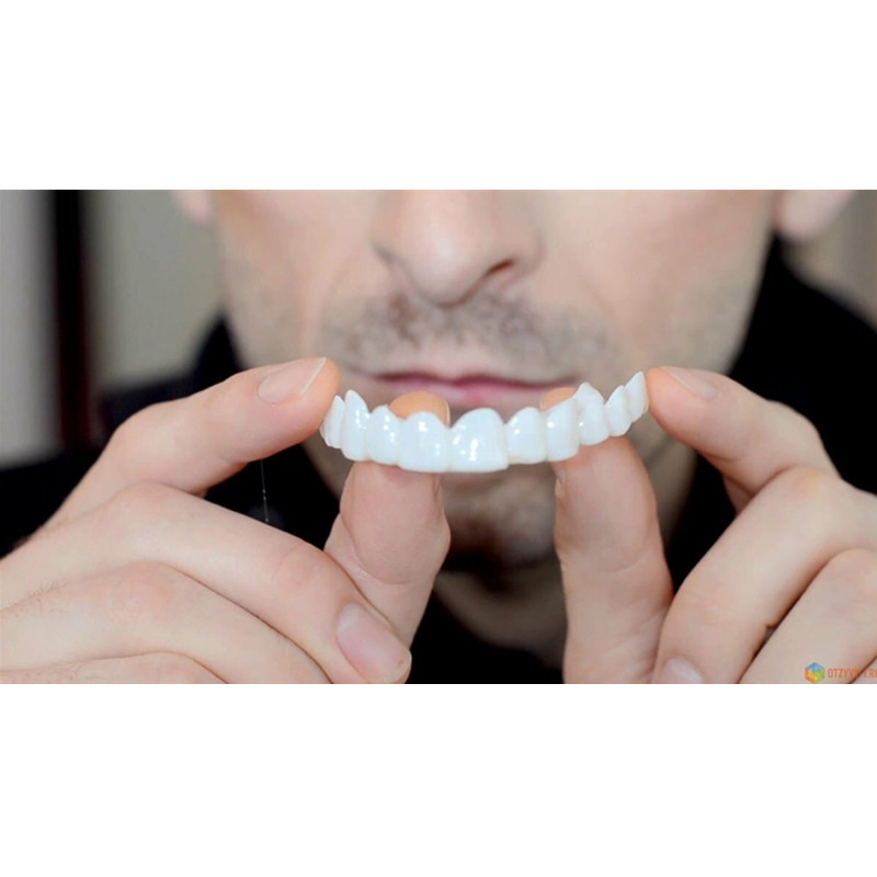 Morbido Gel di Silicone Dental - Teeth Whitening Moulds recensione e prezzo