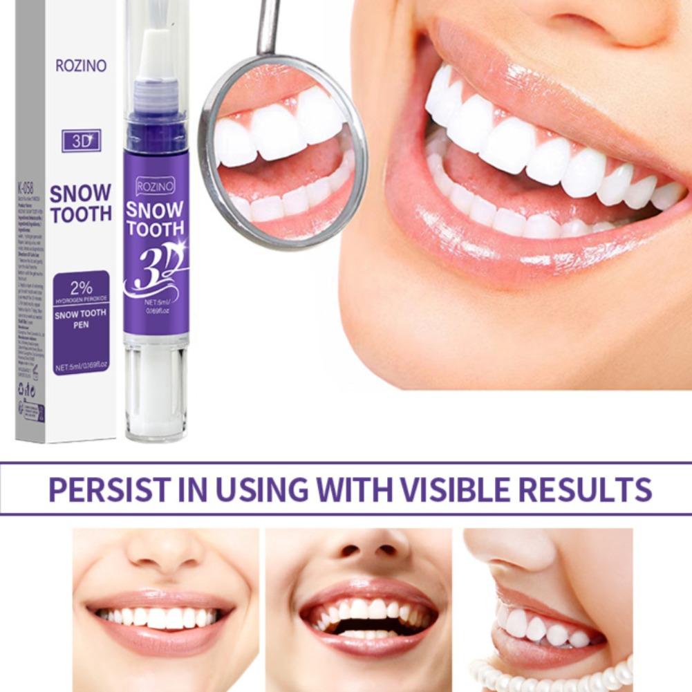 Penna per la cura orale e dent - Teeth Whitening Pens recensione e prezzo
