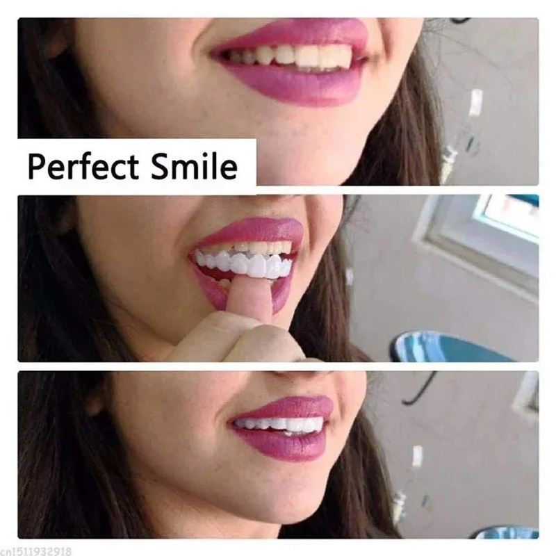 Kit di Denti in Impiallacciatu - Teeth Whitening Kit recensione e prezzo